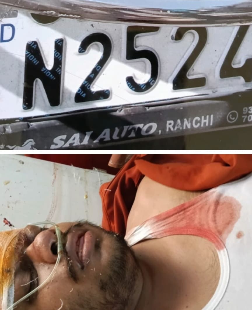 407 ट्रक की चपेट में आने से बाइक सवार गंभीर घायल, हजारीबाग रेफर  